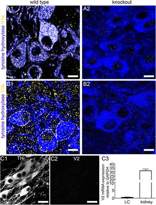 Dynamic Modulation of Mouse Locus Coeruleus Neurons by Vasopressin 1a and 1b Receptors